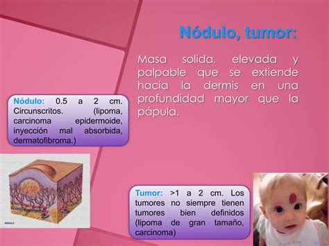 4 lesiones cutáneas primarias y secundarias PPT