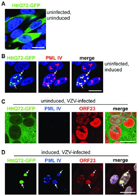 PML IV Cages Cosequester ORF23 Capsid Protein And Huntington S Disease