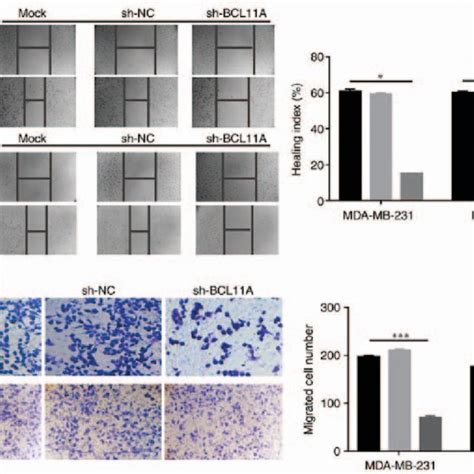 BCL11A Expression In Triple Negative Breast Cancer Tissues And Its