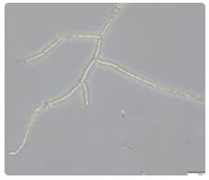 What is Pythium? — Department of Plant Pathology and Environmental Microbiology