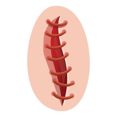 Icono De Sutura Abierta Estilo De Dibujos Animados 14184414 Vector En
