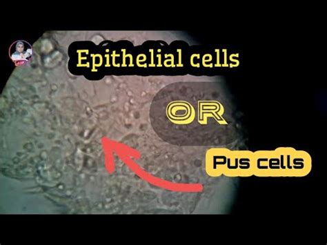 Epithelial Cells Vs