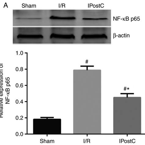 Ipostc Reduces I R Induced Nf κb Activation A Western Blotting