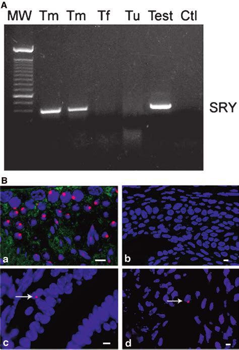 Identification Of Bone Marrowderived Cells In Murine Endometrium A