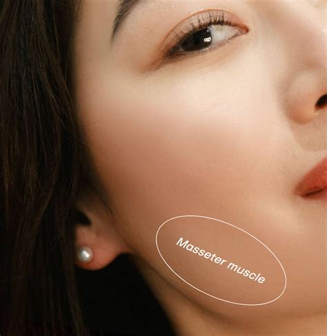 How Does Masseter Botox Slim Your Face U Med Spa Plano Frisco