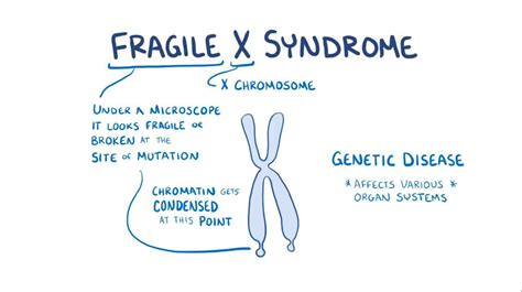 Video Fragile X Syndrome