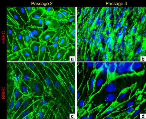 Immunofluorescent Staining For The Tight Junction Protein Zo In Human