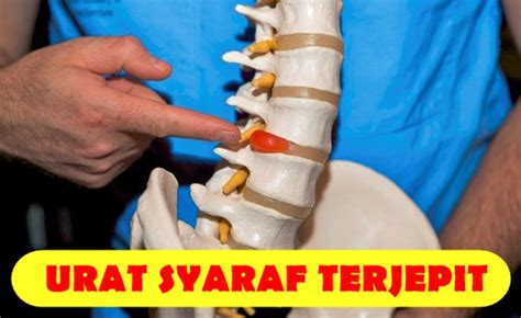 Saraf Terjepit Begini Cara Menanganinya Sehat Azzimut