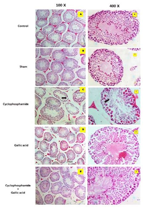 Figure1 Photomicrograph Of Testis From Treated Mice A Control B