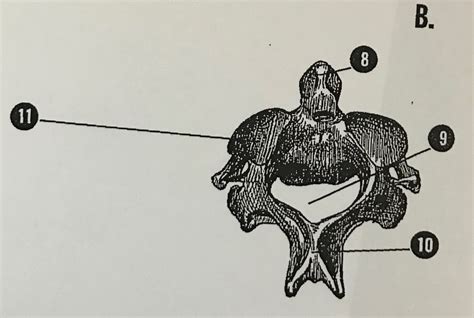 C2 Axis Vertebrae Diagram Quizlet