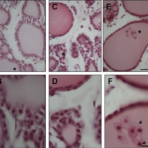 The Photographs Of Rat Thyroid Tissue Stained With Hematoxylin Eosin