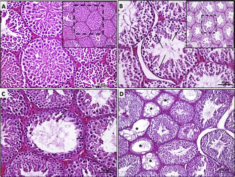 Representative Micrographs Of Testicular Tissue Sections Stained With