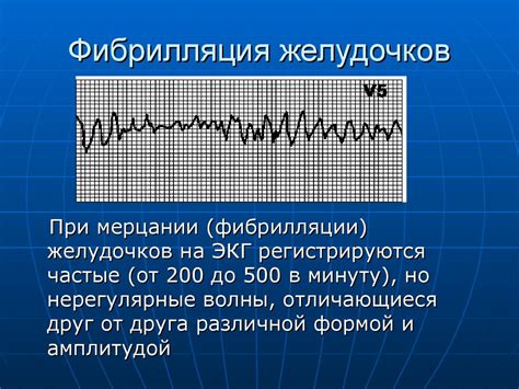 Электрокардиография - online presentation