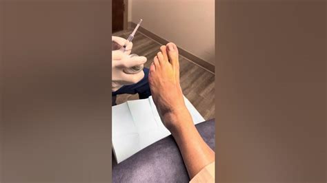 Ingrown Toenail Procedure Part 1 Local Anesthesia Youtube