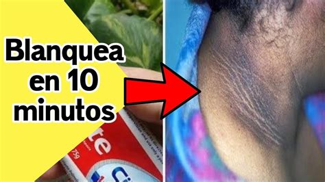 C Mo Deshacerse Del Cuello Oscuro De Forma Permanente En Minutos