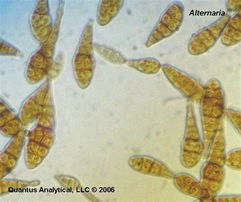 Airborne Mold Spores Increase Kids Risk For Multiple Allergies