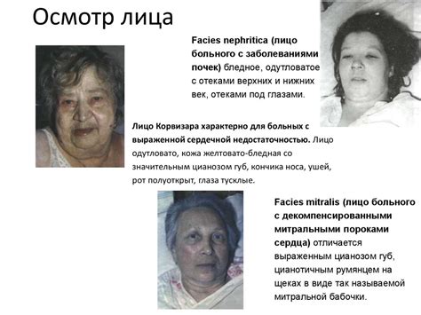 Общий осмотр - презентация онлайн