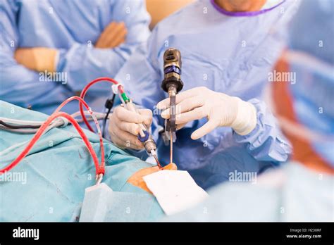 Sinus Surgery Surgeons Performing Functional Endoscopic Sinus Surgery