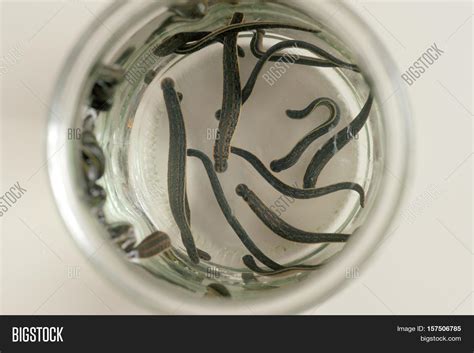 Hirudotherapy Medical Image And Photo Free Trial Bigstock
