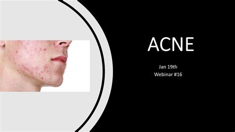 Webinar Acne Recharge Biomedical