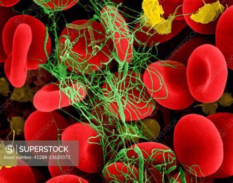 Human Red Blood Cells And Activated Platelets Trapped In A Fibrin Blood