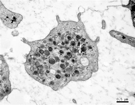 Diagnosing Platelet Disorders Microscopy Australia