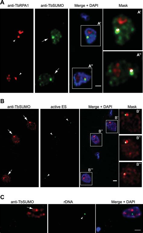 Figure 2 From SUMOylation By The E3 Ligase TbSIZ1 PIAS1 Positively