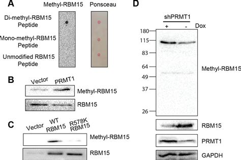 Figures And Data In Cross Talk Between Prmt1 Mediated Methylation And