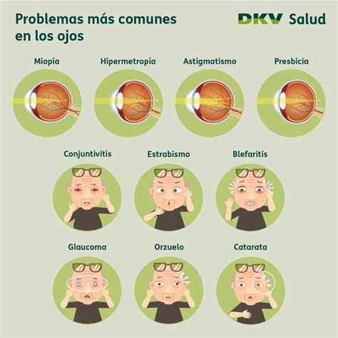 Problemas En Los Ojos Optica Y Optometria Salud Visual Promocion De