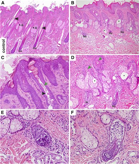 Normal Hair Follicle Histology