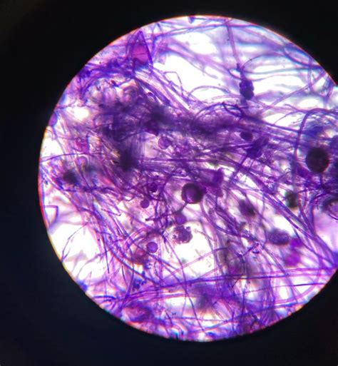 Moho De Tortilla En 100x Del Microscopio