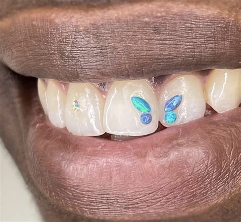 What Dentists Really Think About The Tooth Gem Trend Allure