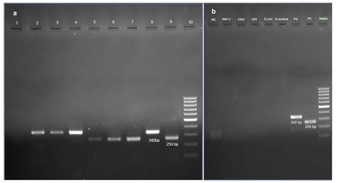 Jof Free Full Text Diagnostic Performance And Clinical Utility Of