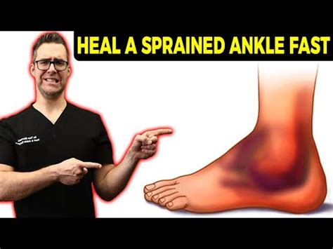 Signs Of Broken Ankle Vs Sprained Ankle Diagnosis Best Treatment