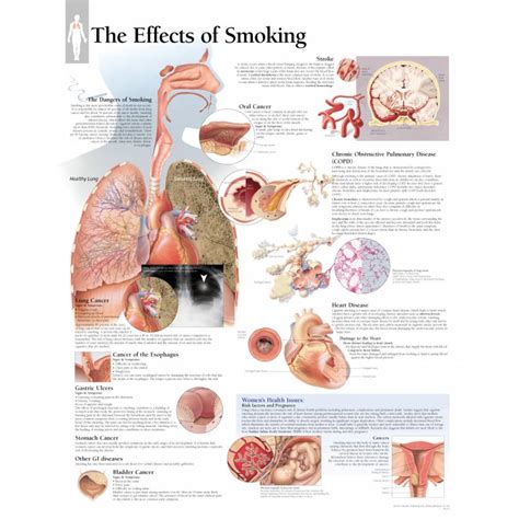 Smoking Is Bad Poster