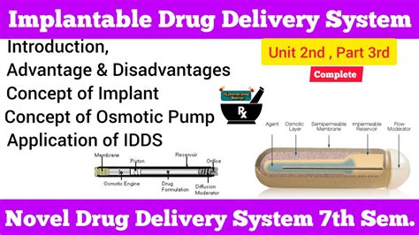 Implantable Drug Delivery System Complete Concept Of Osmotic Pump