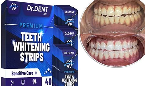 Get A Dazzling Smile With Teeth Whitening Strips Eight Shades Whiter