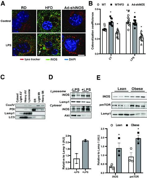 Obesity And Inflammation Promote Lysosomal Localization Of Inos A