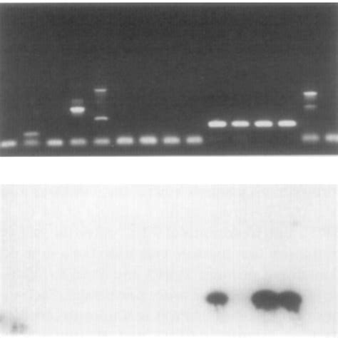 Specificity Of The 16s Rrna Gene Pcr For Yersinieae Polymerase Chain Download Scientific