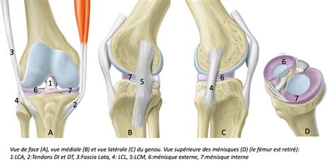 Rupture Du Ligament Crois Ant Rieur Causes Sympt Mes Et Traitements