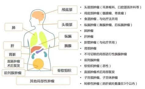 精准放疗中的质子治疗适合哪些肿瘤全球肿瘤医生网