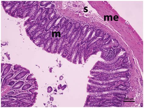 A Section From Group Rome M Mucosa S Submucosa Me Muscularis