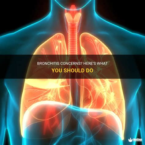 Bronchitis Concerns Here S What You Should Do Medshun