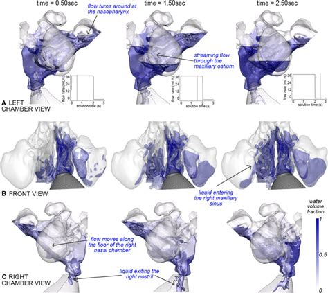 Liquid Flow Through The Nasal Cavity At T And