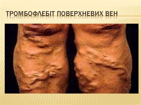Бешиха - презентация онлайн