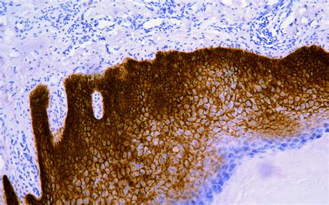 Cd Antibody Rabbit Monoclonal Antibody Mab Ihc Buy Now