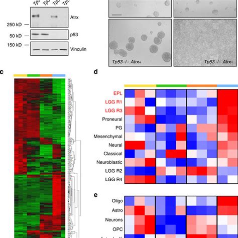 Atrx Deficiency Alters The Morphology And Gene Expression Profiles Of