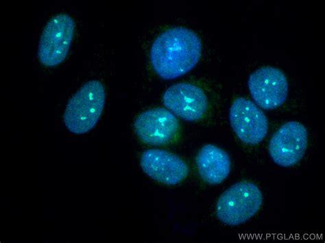 PARP1 antibody 80174 1 RR Proteintech 武汉三鹰生物技术有限公司