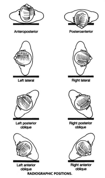 Positioning Terminology Radiology Radiologic Technology Medical