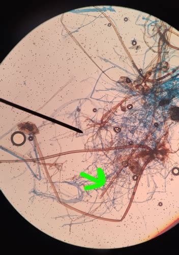 Micro Lab Rhizopus Stolonifera Structures Flashcards Quizlet